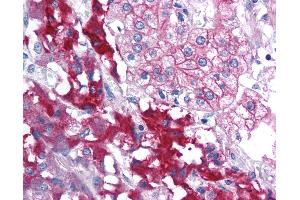 Anti-RPAIN antibody IHC of human adrenal. (RPAIN anticorps  (C-Term))