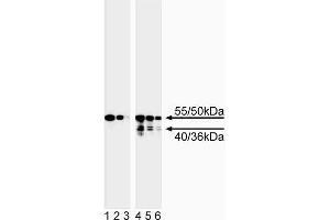 Western blot analysis of caspase-8. (Caspase 8 anticorps)