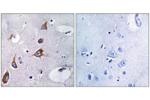 Immunohistochemistry analysis of paraffin-embedded human brain tissue, using CHSY1 antibody. (CHSY1 anticorps  (Internal Region))