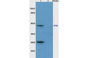 Lane 1: mouse brain lysates Lane 2: mouse embryo lysates probed with Anti phospho-Smad3 (Ser213) Polyclonal Antibody, Unconjugated (ABIN802383) at 1:200 in 4 °C. (SMAD3 anticorps  (pSer213))