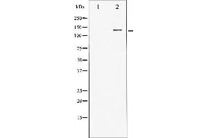 Western blot analysis of HDAC5 expression in HepG2 whole cell lysates,The lane on the left is treated with the antigen-specific peptide. (HDAC5 anticorps)