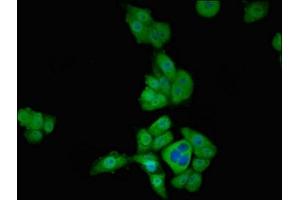 Immunofluorescent analysis of PC-3 cells using ABIN7171293 at dilution of 1:100 and Alexa Fluor 488-congugated AffiniPure Goat Anti-Rabbit IgG(H+L) (T-Box 1 anticorps  (AA 22-107))