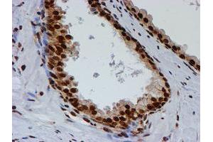 Image no. 15 for anti-Fragile X Mental Retardation 1 (FMR1) antibody (ABIN1498287)