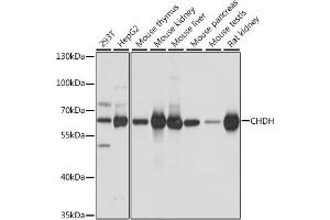 Western blot analysis of extracts of various cell lines, using CHDH antibody (ABIN7266341) at 1:1000 dilution. (CHDH anticorps  (AA 245-594))