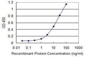 Detection limit for recombinant GST tagged PGM1 is 0. (Phosphoglucomutase 1 anticorps  (AA 1-562))