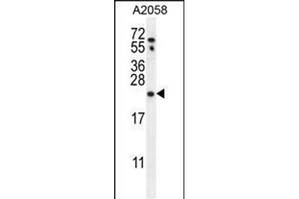 RAB10 antibody  (AA 89-117)