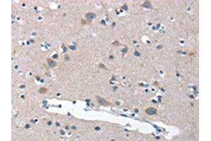 The image on the left is immunohistochemistry of paraffin-embedded Human brain tissue using ABIN7189813(ANP32C Antibody) at dilution 1/30, on the right is treated with synthetic peptide. (ANP32C anticorps)