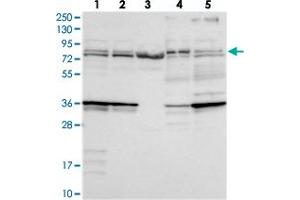 Western blot analysis of Lane 1: RT-4, Lane 2: U-251 MG, Lane 3: Human Plasma, Lane 4: Liver, Lane 5: Tonsil with KATNB1 polyclonal antibody  at 1:250-1:500 dilution. (KATNB1 anticorps)