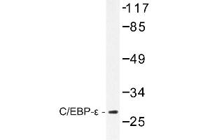 Image no. 1 for anti-CCAAT/enhancer Binding Protein (C/EBP), epsilon (CEBPE) antibody (ABIN272198) (CEBPE anticorps)