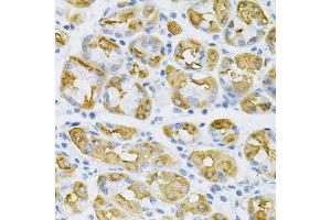 Immunohistochemistry of paraffin-embedded human stomach using SDC4 Antibody (ABIN5970935) at dilution of 1/100 (40x lens). (SDC4 anticorps)