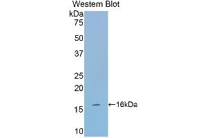 Western Blotting (WB) image for anti-Tryptase alpha/beta 1 (TPSAB1) (AA 149-273) antibody (ABIN1174174) (TPSAB1 anticorps  (AA 149-273))
