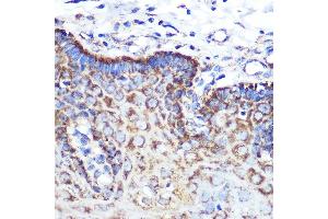 Immunohistochemistry of paraffin-embedded human esophageal using  Rabbit mAb (ABIN7265589) at dilution of 1:100 (40x lens). (Angiopoietin 2 anticorps)