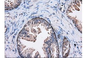 Immunohistochemical staining of paraffin-embedded Human liver tissue using anti-TBXAS1 mouse monoclonal antibody. (TBXAS1 anticorps)