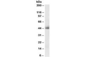 Western blot testing of human kidney lysate with CA12 antibody at 0. (CA12 anticorps)