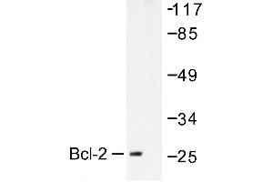 Image no. 1 for anti-B-Cell CLL/lymphoma 2 (BCL2) antibody (ABIN271996) (Bcl-2 anticorps)