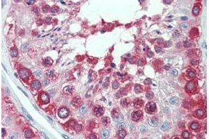 Human Testis: Formalin-Fixed, Paraffin-Embedded (FFPE)