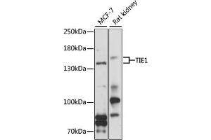 Western blot analysis of extracts of various cell lines, using TIE1 antibody (ABIN1683033, ABIN3017717, ABIN3017718 and ABIN6220214) at 1:1000 dilution. (TIE1 anticorps  (AA 350-600))