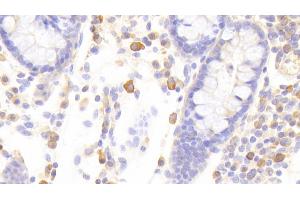 Detection of STAT1 in Human Colon Tissue using Polyclonal Antibody to Signal Transducer And Activator Of Transcription 1 (STAT1)