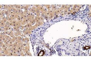 Detection of CK17 in Human Liver Tissue using Polyclonal Antibody to Cytokeratin 17 (CK17)