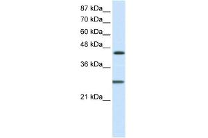 WB Suggested Anti-HES6 Antibody Titration:  1. (HES6 anticorps  (C-Term))