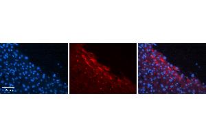 Rabbit Anti-CTAGE5 Antibody   Formalin Fixed Paraffin Embedded Tissue: Human Liver Tissue Observed Staining: Plasma membrane in hepatocytes Primary Antibody Concentration: 1:100 Other Working Concentrations: N/A Secondary Antibody: Donkey anti-Rabbit-Cy3 Secondary Antibody Concentration: 1:200 Magnification: 20X Exposure Time: 0. (MIA2 anticorps  (N-Term))