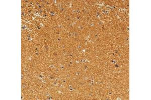 IHC analysis of Syntaphilin/SNPH using anti-Syntaphilin/SNPH antibody (ABIN7601724). (Syntaphilin anticorps  (AA 43-482))