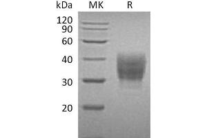 Western Blotting (WB) image for SLAM Family Member 7 (SLAMF7) protein (His tag) (ABIN7320737)