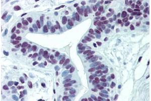 Human Breast: Formalin-Fixed, Paraffin-Embedded (FFPE) (CDKL1 anticorps  (AA 259-358))