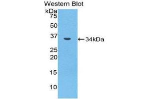 Western Blotting (WB) image for anti-Matrix Metallopeptidase 7 (Matrilysin, Uterine) (MMP7) (AA 1-264) antibody (ABIN1859856) (MMP7 anticorps  (AA 1-264))