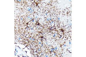 Immunohistochemistry of paraffin-embedded human brain using GFAP Rabbit mAb (ABIN7267389) at dilution of 1:100 (40x lens).