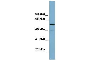 WB Suggested Anti-CDK5RAP1 Antibody Titration: 0. (CDK5RAP1 anticorps  (N-Term))