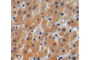 IHC-P analysis of liver tissue, with DAB staining.