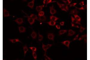 ABIN6275199 staining NIH-3T3 by IF/ICC. (ICAM2 anticorps  (Internal Region))