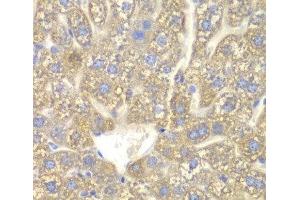 Immunohistochemistry of paraffin-embedded Mouse liver using CYP2C18 Polyclonal Antibody at dilution of 1:100 (40x lens).