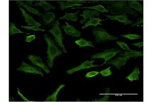 Immunofluorescence of monoclonal antibody to SGK2 on HeLa cell.