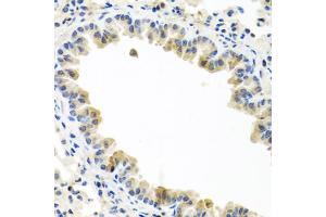 Immunohistochemistry of paraffin-embedded mouse lung using BMP5 antibody (ABIN5974675) at dilution of 1/100 (40x lens).