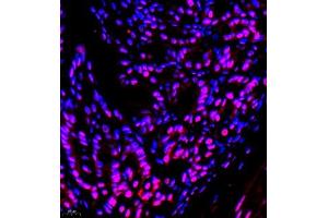 Immunofluorescence of paraffin embedded mouse stomach using TFIIIC110 (ABIN7074038) at dilution of 1:650 (400x lens)