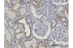 Immunoperoxidase of monoclonal antibody to TNFRSF14 on formalin-fixed paraffin-embedded human kidney.