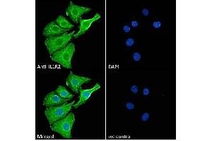 (ABIN570867) Immunofluorescence analysis of paraformaldehyde fixed A549 cells, permeabilized with 0. (IL1R2 anticorps  (Internal Region))