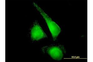 Immunofluorescence of purified MaxPab antibody to CYP2E1 on HeLa cell.