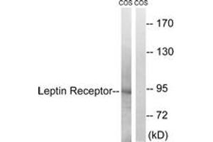 Western blot analysis of extracts from COS7 cells, treated with calyculinA 50ng/ml 30', using Leptin Receptor (Ab-1141) Antibody. (Leptin Receptor anticorps  (AA 1107-1156))