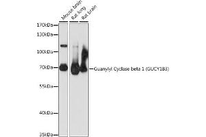 Western blot analysis of extracts of various cell lines, using Guanylyl Cyclase beta 1 (Guanylyl Cyclase beta 1 (GUCY1B3)) antibody (ABIN7267552) at 1:1000 dilution.