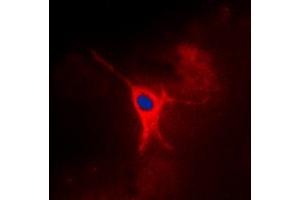 Immunofluorescent analysis of AMPK gamma 2 staining in MCF7 cells.