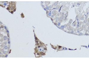 Immunohistochemistry of paraffin-embedded Rat testis using ESRRA Polyclonal Antibody at dilution of 1:200 (40x lens). (ESRRA anticorps)