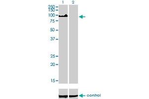 Western blot analysis of ZHX2 over-expressed 293 cell line, cotransfected with ZHX2 Validated Chimera RNAi (Lane 2) or non-transfected control (Lane 1).