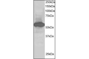 Antibody staining (1 µg/ml) of Human Kidney lysate (RIPA buffer, 30 µg total protein per lane). (SIL1 anticorps  (C-Term))