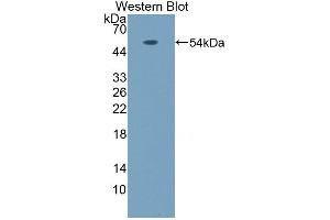 Detection of Recombinant NPR3, Rat using Polyclonal Antibody to Natriuretic Peptide Receptor 3 (NPR3) (NPR3 anticorps  (AA 45-467))