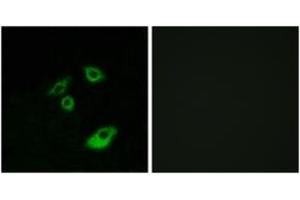 Immunofluorescence analysis of A549 cells, using BCL-2 (Phospho-Thr56) Antibody. (Bcl-2 anticorps  (pThr56))