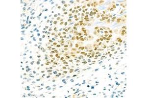 Immunohistochemistry of paraffin embedded mouse embryonic mouse using SP7 (ABIN7075694) at dilution of 1:200 (400x lens)