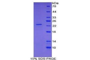 SDS-PAGE analysis of Human Shisa Homolog 4 Protein. (SHISA4 Protéine)